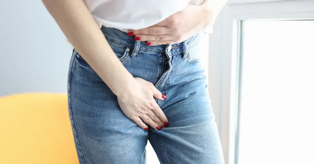 女性の鼠径ヘルニア